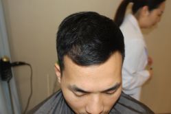 -大麦微针植发丨全国连锁