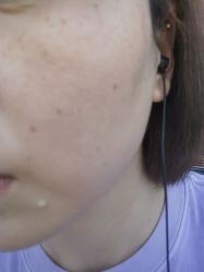 点击看大图 体验前-德媛医疗美容