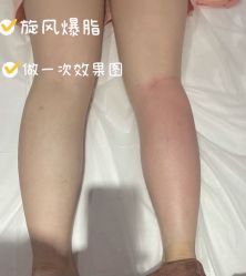-Lily纤美·科技减脂中心