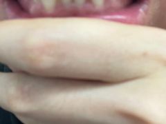 -微笑牙科口腔(三亚迎宾院区)