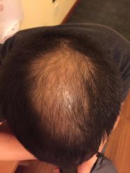 -乐绅男士高端假发定制