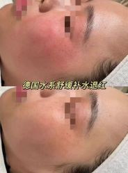 -春田皮肤管理中心品牌旗舰店