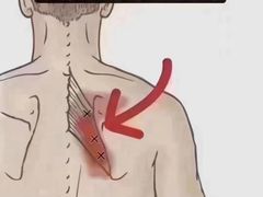 -泰融玺·泰式按摩SPA(包河万达店)