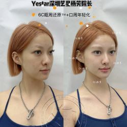 -深圳艺星医疗美容医院