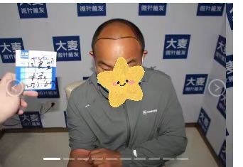-大麦微针植发丨全国连锁