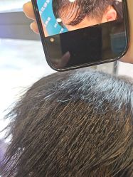 -碧莲盛·不剃发植发