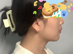 -极光口腔·矫正种植修复(锦江店)
