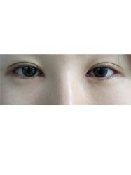 咋样看着-伊美尔医疗美容医院