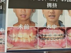 -大白象口腔连锁·矫正·种植中心(玺悦城店)