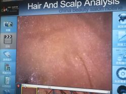 -雍禾植发全国连锁