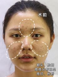 -广州美莱医疗美容医院