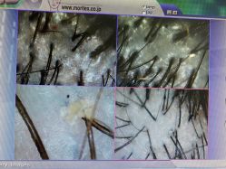 -新生植发·植养护一体