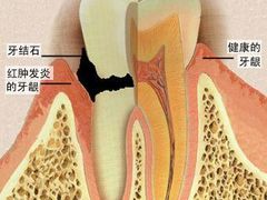 -团圆口腔·种植中心(锦江院区)