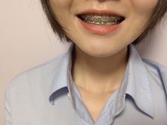 -美酷口腔牙齿矫正(江桥万达店)