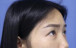 -天津健丽·去眼袋医疗美容机构