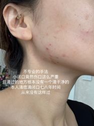 体验后-演员的秘密·皮肤管理