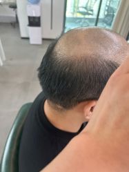 -极客侠男士假发定制补发