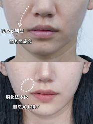 -素美医疗美容·西南眼鼻整形·修复基地