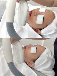 -慕颜医疗美容·皮肤微整 抗衰