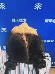 -雍禾植发全国连锁