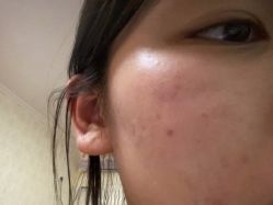 体验后-联合丽格·张菡丽格医疗美容