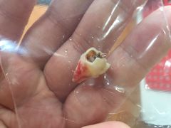 iphone_upload_pic-新达口腔(华东理工大学店)