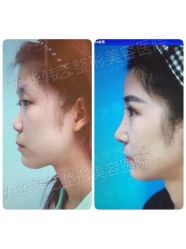 点击看大图 -大华韩艺整形美容医院