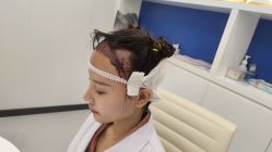 -大麦微针植发全国连锁