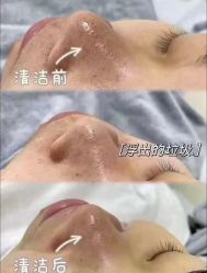 点击看大图 -VE专注问题肌·赛诺龙&科学美肤中心