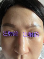 -天津伊美尔医疗整形美容专科医院