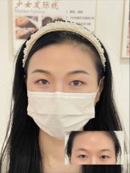 -杨益美学·野生眉半永久纹眉发际线