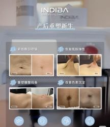 -半岛故事·法儿曼抗衰·indiba中心