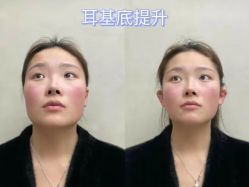 点击看大图 -Yestar艺星医疗美容医院