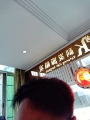 -大麦微针植发全国连锁