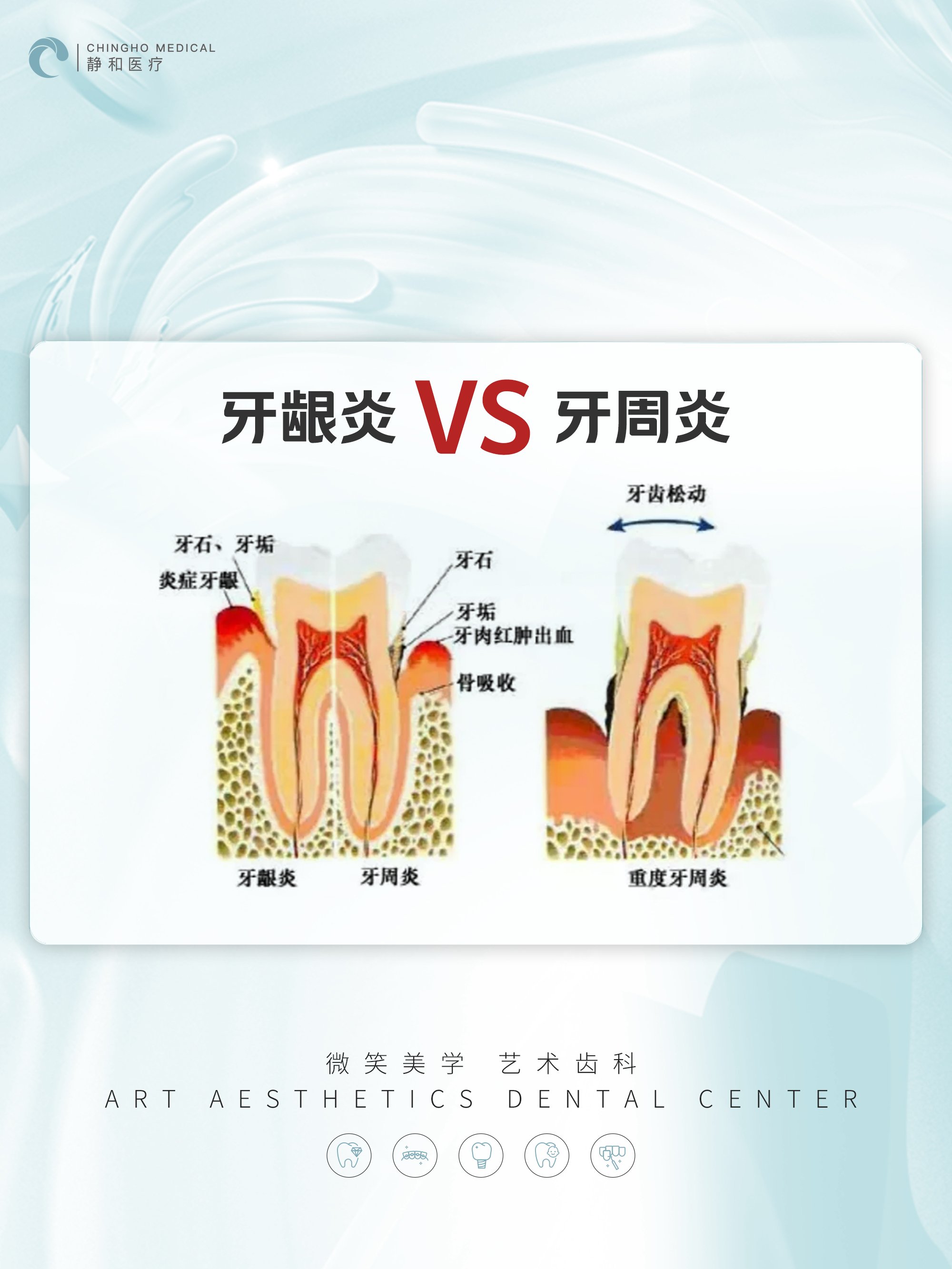 牙龈炎图片大全图解图片