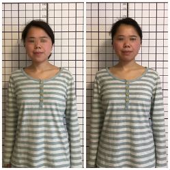 -FACE·日本小颜矫正美容整骨サロン