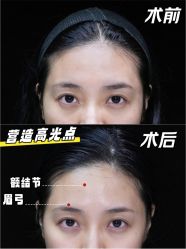 -深圳艺星医疗美容医院