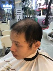 -发饰美男士增发补发假发定制店