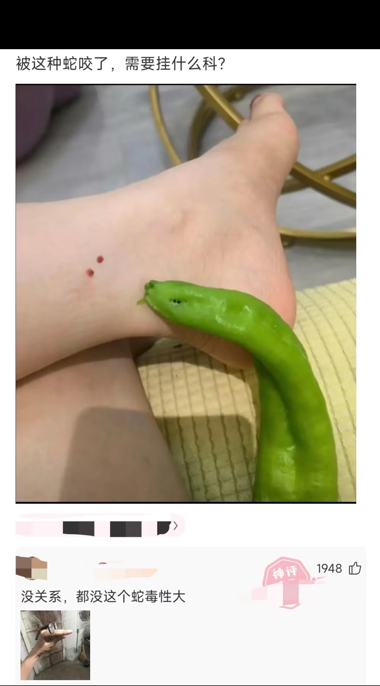 被蛇咬出血了怎么办（被蛇咬伤出血） 被蛇咬出血了怎么办（被蛇咬伤出血） 卜算大全