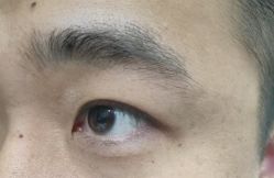-北京美痣堂古方祛痣斑疣瘊
