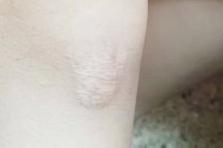 -成都军建医院·疤痕诊疗中心