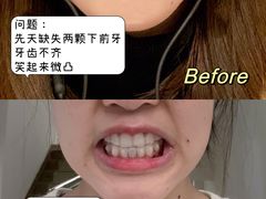-极光口腔·矫正种植修复(锦江店)