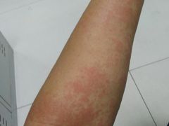-龙达温泉生态城