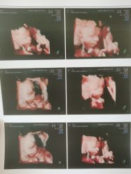 -杭州贝瑞斯美华妇儿医院·早孕·产检·儿科