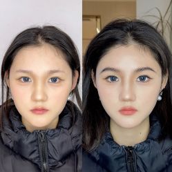 点击看大图 -杨益美学·野生眉半永久纹眉发际线