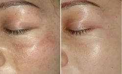 -SKINIST丽铂医疗美容