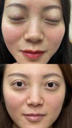 -韩辰医疗整形美容医院