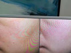 体验后-苑苑vbeauty科技美容SPA