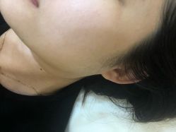 -DMK酶疗中心·BeautyYoung舒妍科技美肤