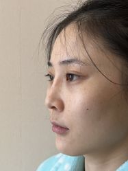 -北京米扬丽格医疗美容·联合丽格鼻整形中心